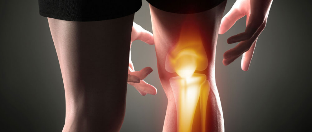 Knee Osteoarthritis